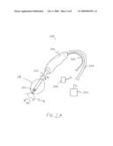 Dual cutting element tool for debulking bone diagram and image