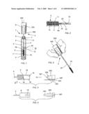 APPLICATOR FOR APPLYING A COMPOSITION TO KERATINOUS MATERIALS AND INCLUDING A SOURCE OF VIBRATION diagram and image