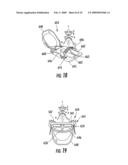 HAND MOUNT diagram and image