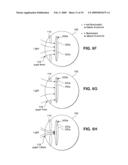 MULTI-FOCAL INTRAOCULAR LENS SYSTEM AND METHODS diagram and image