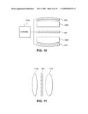 MULTI-FOCAL INTRAOCULAR LENS SYSTEM AND METHODS diagram and image