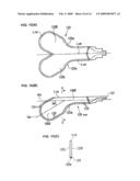 Inflatable Belt, And Inflatable Belt Apparatus diagram and image