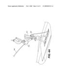 Lifting device suitable for submersibles diagram and image