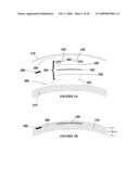 OPHTHALMIC DYNAMIC APERTURE diagram and image