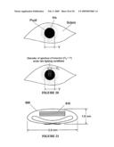 OPHTHALMIC DYNAMIC APERTURE diagram and image