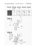 Abnormal tissue pattern detection apparatus, method and program diagram and image