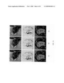 Expanded Pharmacokinetic Model for Population Studies in Breast Magnetic Resonance Imaging (MRI) diagram and image