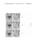 Expanded Pharmacokinetic Model for Population Studies in Breast Magnetic Resonance Imaging (MRI) diagram and image