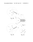 DOCTOR BLADE CHAMBER FOR HIGH VISCOUS INK diagram and image