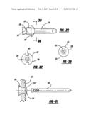 Blind rivet diagram and image