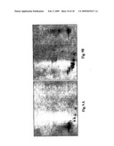 Truncated Fragments of Alpha-Synuclein in Lewy Body Disease diagram and image