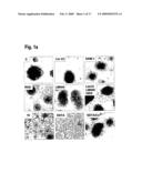 COMBINATION THERAPY USING ANTI-ANGIOGENIC AGENTS AND TNF alpha diagram and image