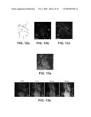 DERIVATION OF NEURAL STEM CELLS FROM EMBRYONIC STEM CELLS AND METHODS OF USE THEREOF diagram and image