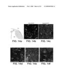 DERIVATION OF NEURAL STEM CELLS FROM EMBRYONIC STEM CELLS AND METHODS OF USE THEREOF diagram and image