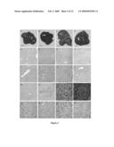 Glycine N-methyltransferase (GNMT) Animal model and use thereof diagram and image