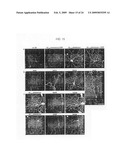 Screening Method, Process for Purifying of Non-Diffusible A-Beta Oligomers, Selective Antibodies Against Said Non-Diffusible a-Beta Oligomers and a Process for Manufacturing of Said Antibodies diagram and image