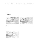 Nuclear Receptors Agonists for Treatment of Atherosclerosis and/or Related Cardiovascular Disease diagram and image