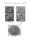 Composite scaffolds and methods using same for generating complex tissue grafts diagram and image