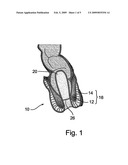 Device and Method for Treating the Anal Sphincter diagram and image