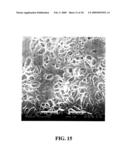 COMPOSITE MATERIALS COMPRISING SUPPORTED POROUS GELS diagram and image