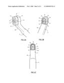 Cure through laminate veneer applicator diagram and image