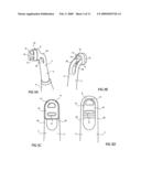 Cure through laminate veneer applicator diagram and image