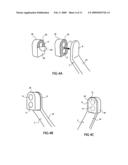 Cure through laminate veneer applicator diagram and image