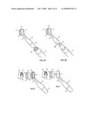 Cure through laminate veneer applicator diagram and image