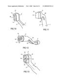 Cure through laminate veneer applicator diagram and image