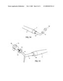 Cure through laminate veneer applicator diagram and image