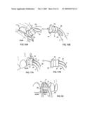 Cure through laminate veneer applicator diagram and image