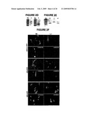 NPC1L1 AND NPC1L1 INHIBITORS AND METHODS OF USE THEREOF diagram and image