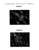 NPC1L1 AND NPC1L1 INHIBITORS AND METHODS OF USE THEREOF diagram and image