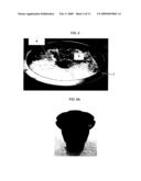 Method and device for extracting and/or collecting blood from placenta and/or umbilical cord diagram and image