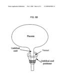 Method and device for extracting and/or collecting blood from placenta and/or umbilical cord diagram and image