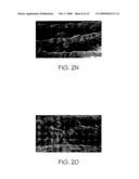 Compositions useful for and methods of modulating angiogenesis diagram and image