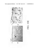 COMPOSITIONS AND METHODS FOR TREATING NEOPLASTIC DISEASES diagram and image