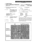 Treatment Of Posterior Capsule Opacification diagram and image