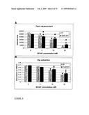 Treatment Of Posterior Capsule Opacification diagram and image