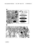 Treatment Of Posterior Capsule Opacification diagram and image