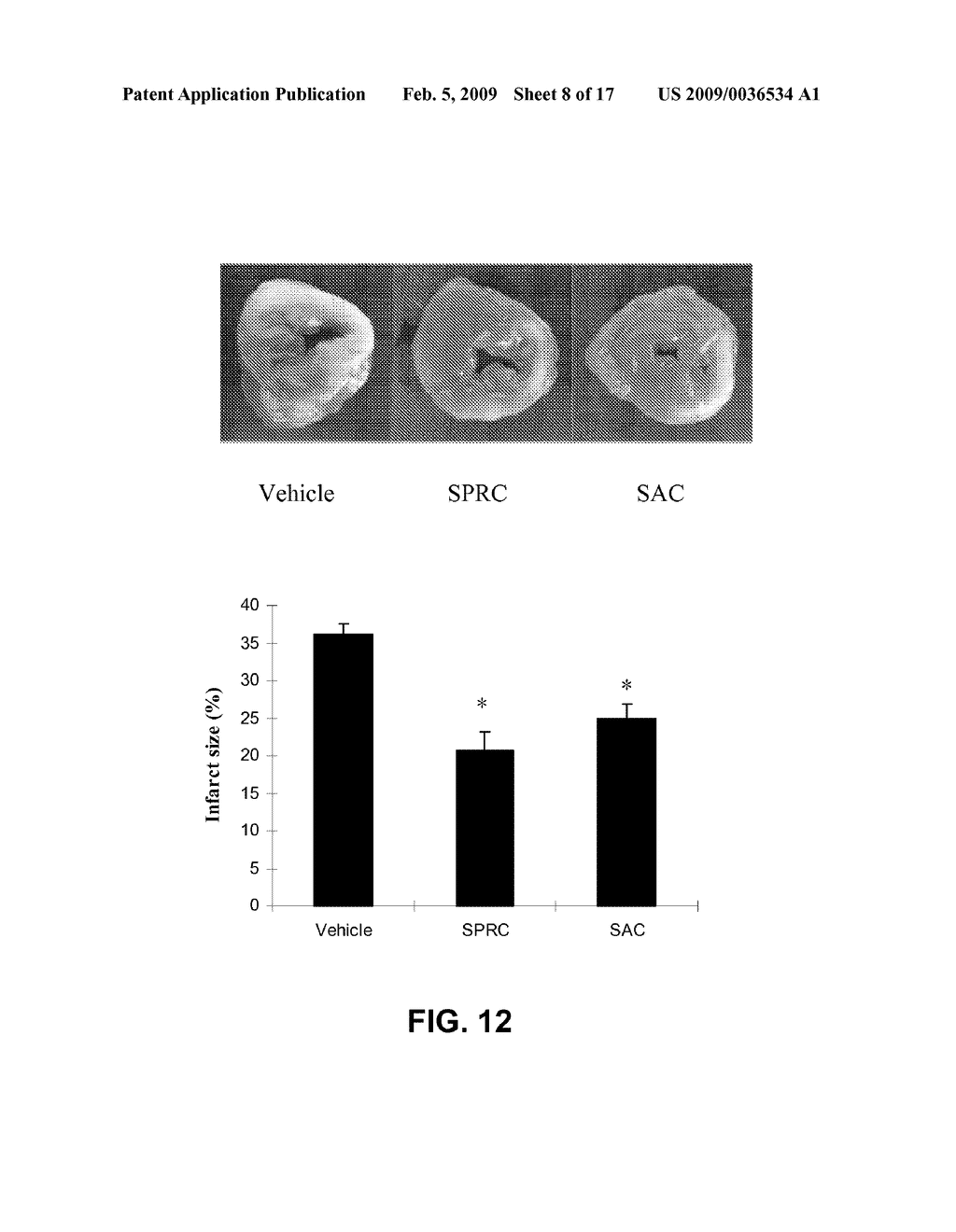 Method Of Synthesizing S-Allyl-Cysteine Analogues And Their Therapeutic Application In Treating Myocardial Infarction - diagram, schematic, and image 09