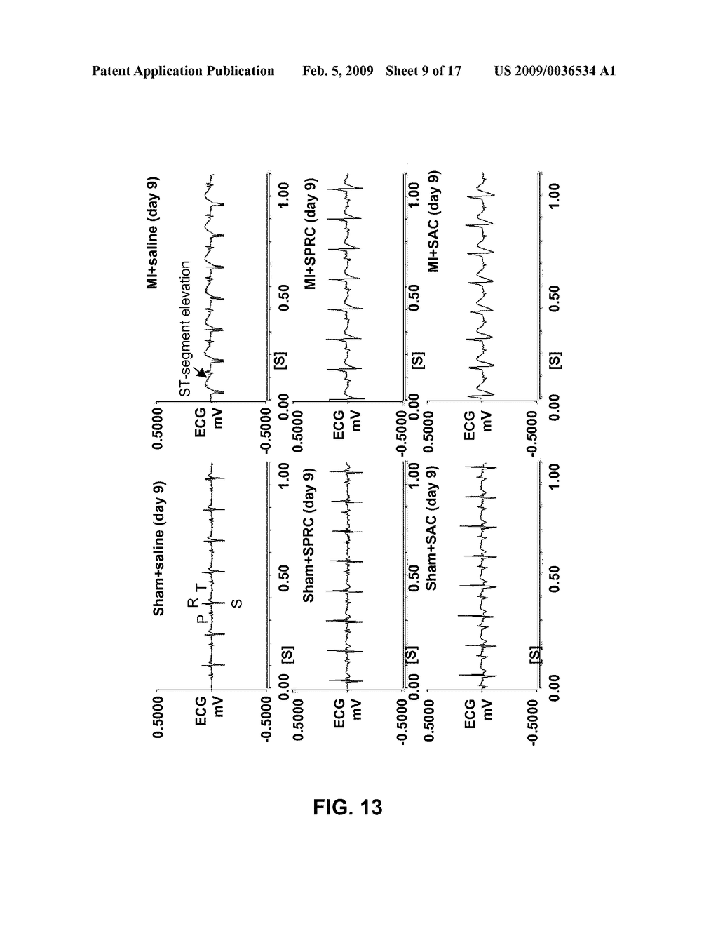 Method Of Synthesizing S-Allyl-Cysteine Analogues And Their Therapeutic Application In Treating Myocardial Infarction - diagram, schematic, and image 10