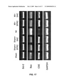 Method Of Synthesizing S-Allyl-Cysteine Analogues And Their Therapeutic Application In Treating Myocardial Infarction diagram and image