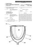 Device for Proactive Modulation of Cardiac Strain Patterns diagram and image