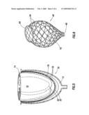 Device for Proactive Modulation of Cardiac Strain Patterns diagram and image