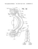 Noninvasive measurement of chemical substances diagram and image