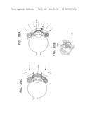 Noninvasive measurement of chemical substances diagram and image