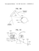 Noninvasive measurement of chemical substances diagram and image