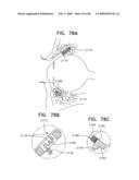 Noninvasive measurement of chemical substances diagram and image