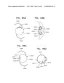 Noninvasive measurement of chemical substances diagram and image